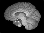 Image that combines data from MRI, fMRI, PET and electrodes placed on the brain