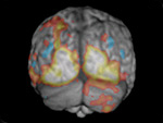 Language mapping with functional MRI