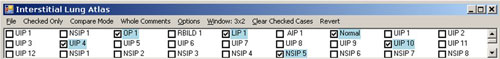 Interstitial Lung Checked Only