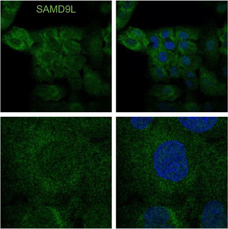 SAMD9L green and blue