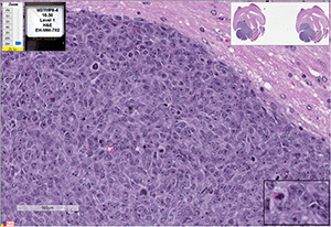 PBT-04FH cells