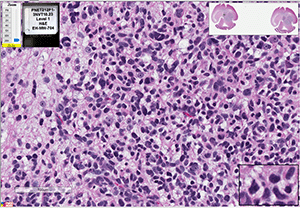 PBT-06FH cells