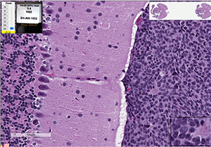 PBT-08FH cells