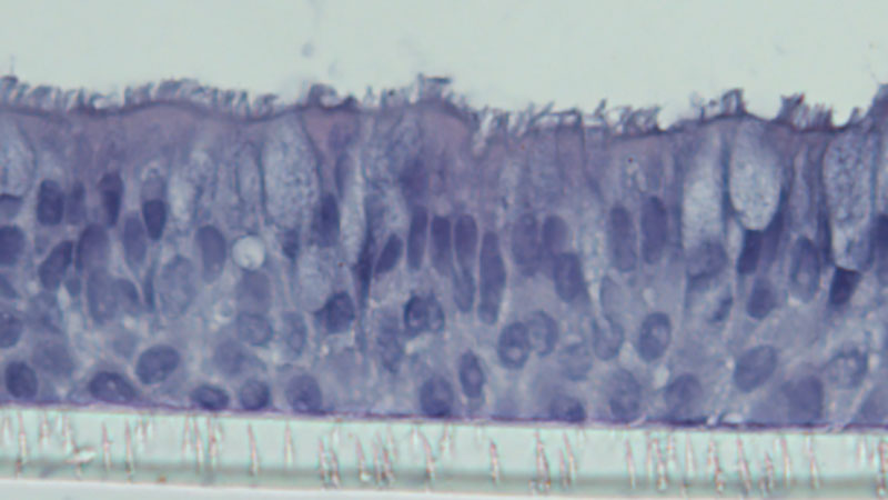 Cell culture